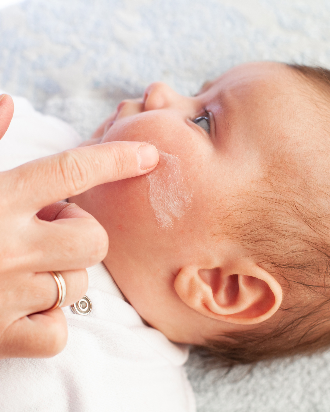 Baby of kind met eczeem? Ontdek de impact van de geboorte